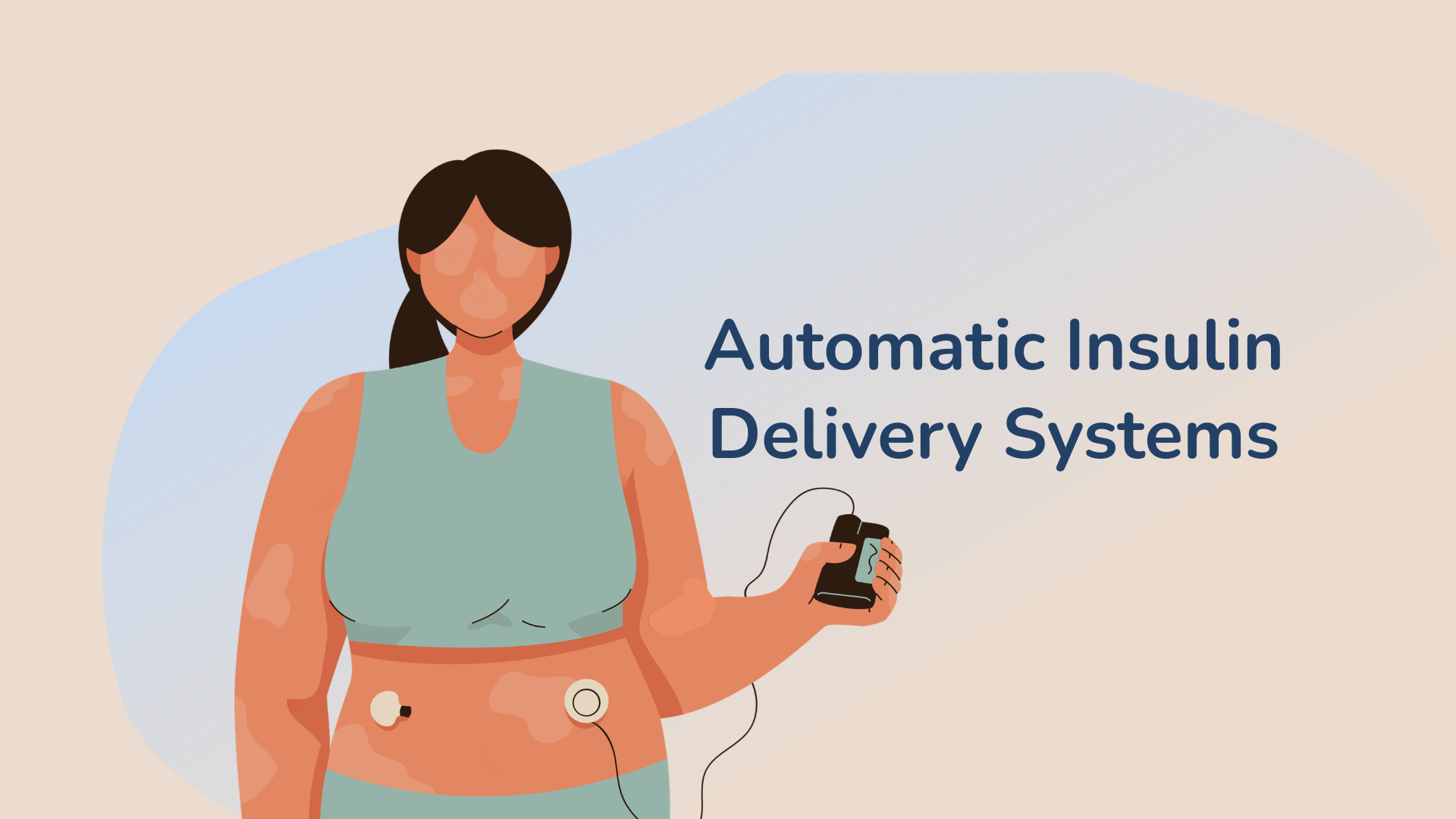 Automatic Insulin Delivery (AID) Systems for Type 1 Diabetes